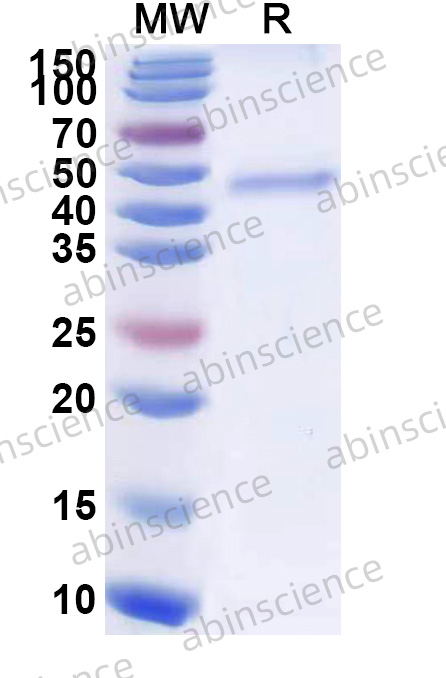 Orthohantavirus puumalaense Glycoprotein N/Gn Recombinant Protein (N-His)