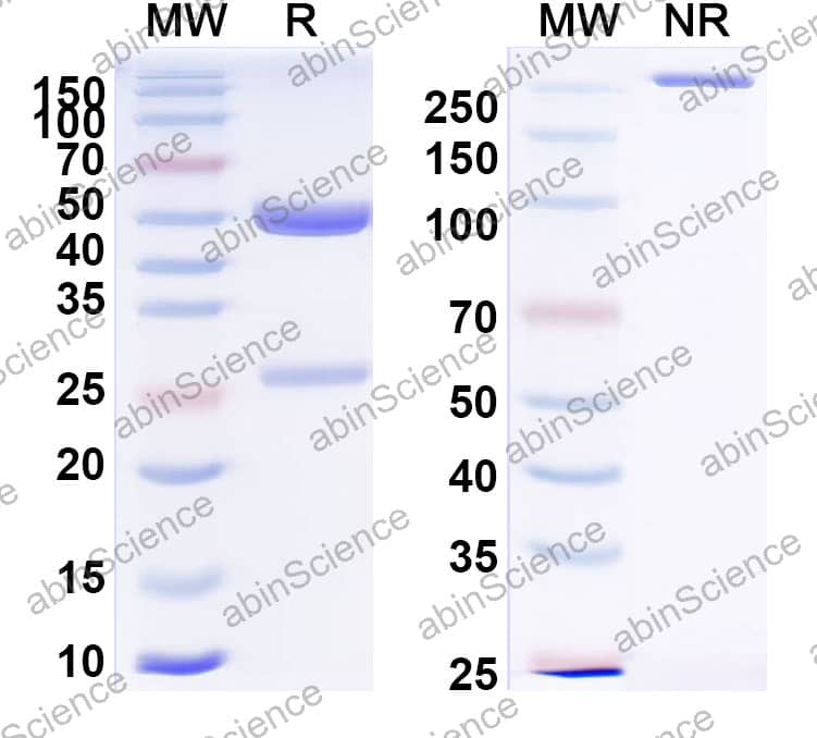 Anti-Hantaan virus/HTNV Glycoprotein N/Gn Antibody (SAA2516)