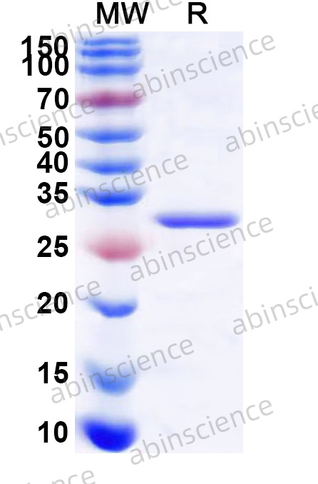 HTNV Nucleoprotein Recombinant Protein (N-His)