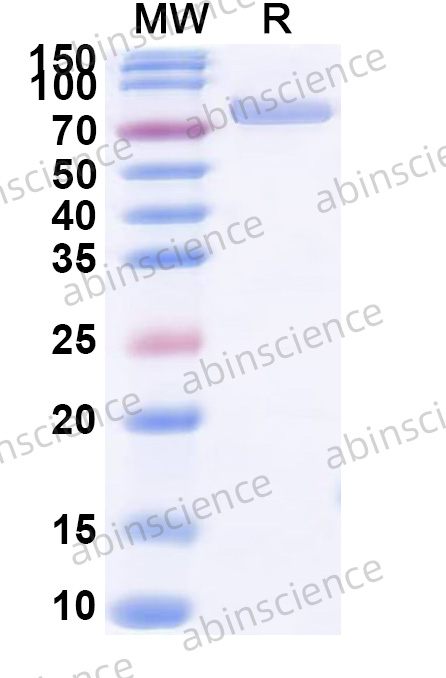 Recombinant HPV16 L2 Protein, N-His