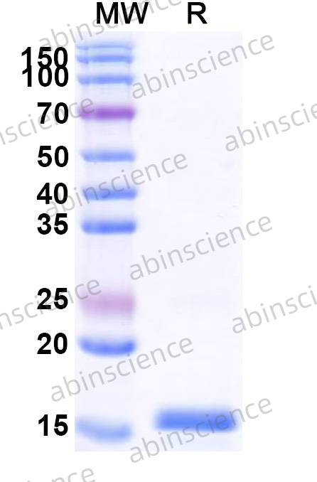Recombinant ZEBOV VP35 Protein, N-His