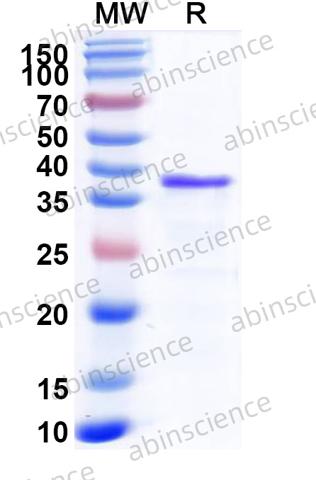 HMPV G/Major surface glycoprotein G Recombinant Protein (N-His)