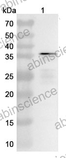 Anti-HMPV G/Major surface glycoprotein G Polyclonal Antibody