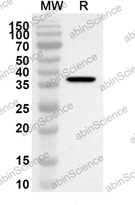 Anti-HMPV G/Major surface glycoprotein G Polyclonal Antibody