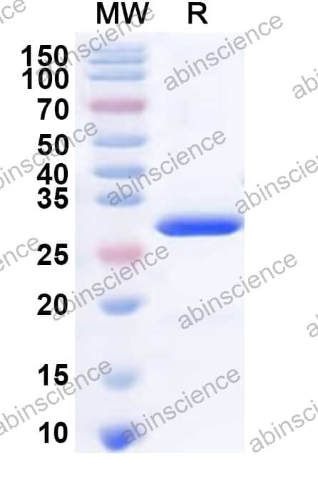 RV-A NSP3 Recombinant Protein (N-His)