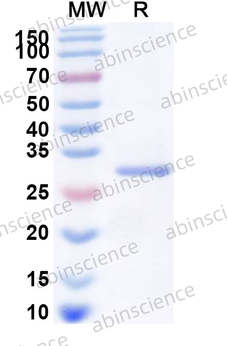 RV-A VP2 Recombinant Protein (N-His)