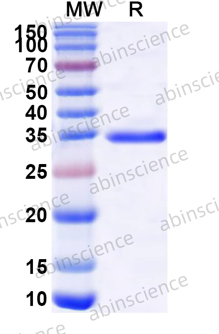 RV-A VP3 Recombinant Protein (N-His)