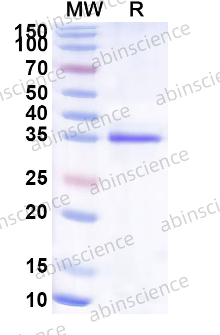 Recombinant RV-A NSP2 Protein, N-His