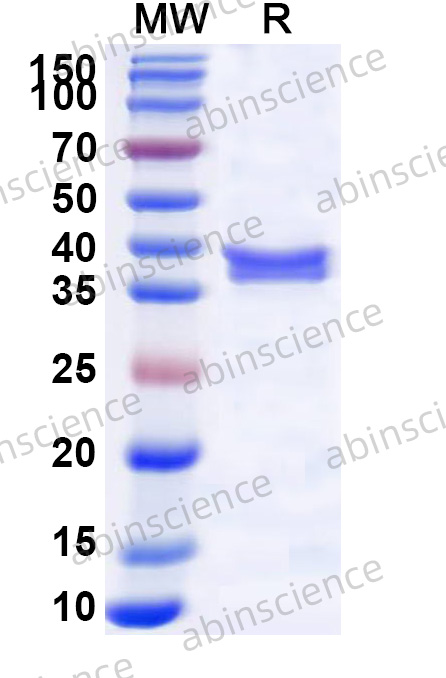 RV-A NSP4 Recombinant Protein (N-GST & C-His)