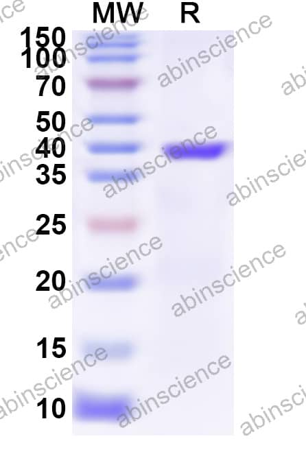 RV-A NSP5 Recombinant Protein (N-His-KSI)
