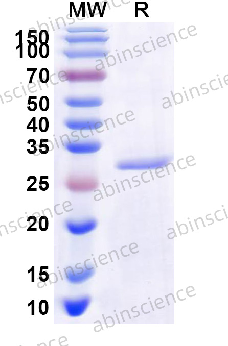 VZV/HHV-3 gH/Envelope glycoprotein H Recombinant Protein (N-His)