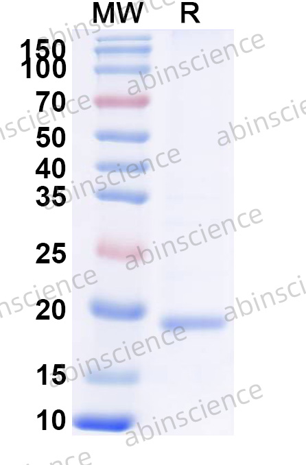 HBV HBeAg Recombinant Protein (N-His)
