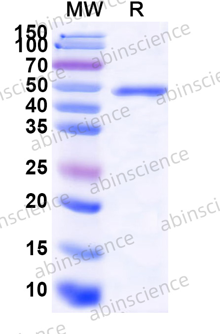 Recombinant ZEBOV VP40 Protein, N-His-SUMO