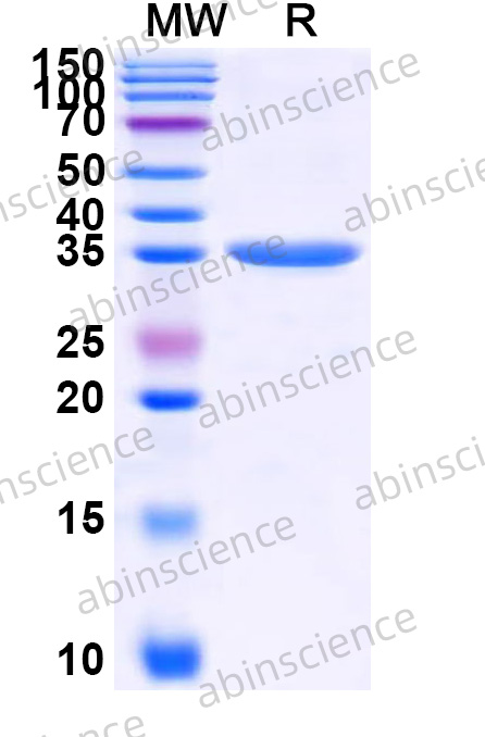 Recombinant ZEBOV VP40 Protein, N-His