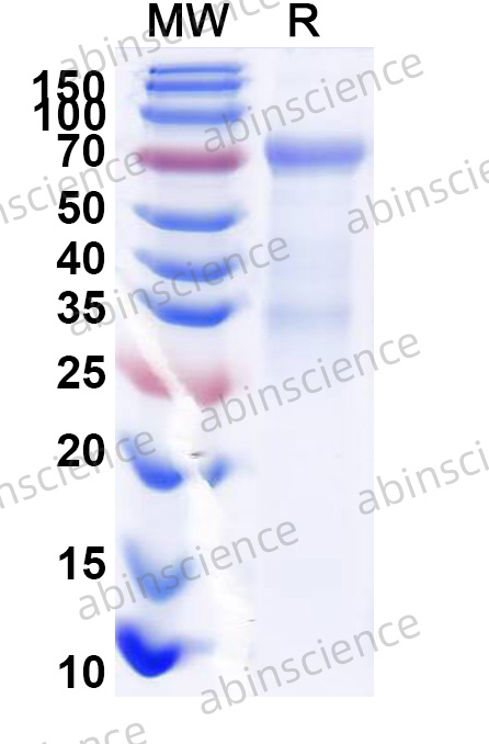EBV/HHV-4 gB/BALF4 Recombinant Protein (C-Fc)
