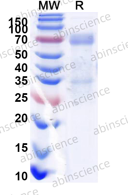 EBV/HHV-4 gB/BALF4 Recombinant Protein (C-Fc)