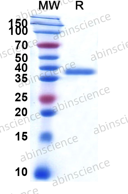 MERS-CoV Spike Glycoprotein NTD Recombinant Protein (N-His)
