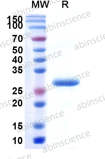 MERS-CoV Spike Glycoprotein RBD Recombinant Protein (N-His)