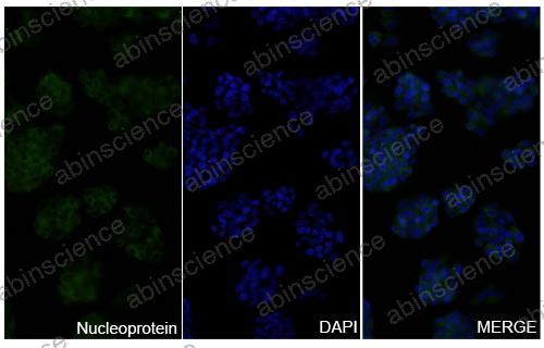 Anti-SARS-CoV-2 Nucleoprotein Recombinant Nanobody (SAA0961)