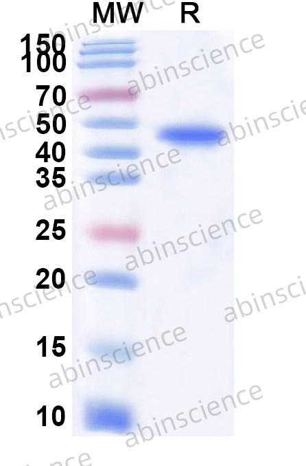 Recombinant SARS-CoV Nucleoprotein Protein, N-His
