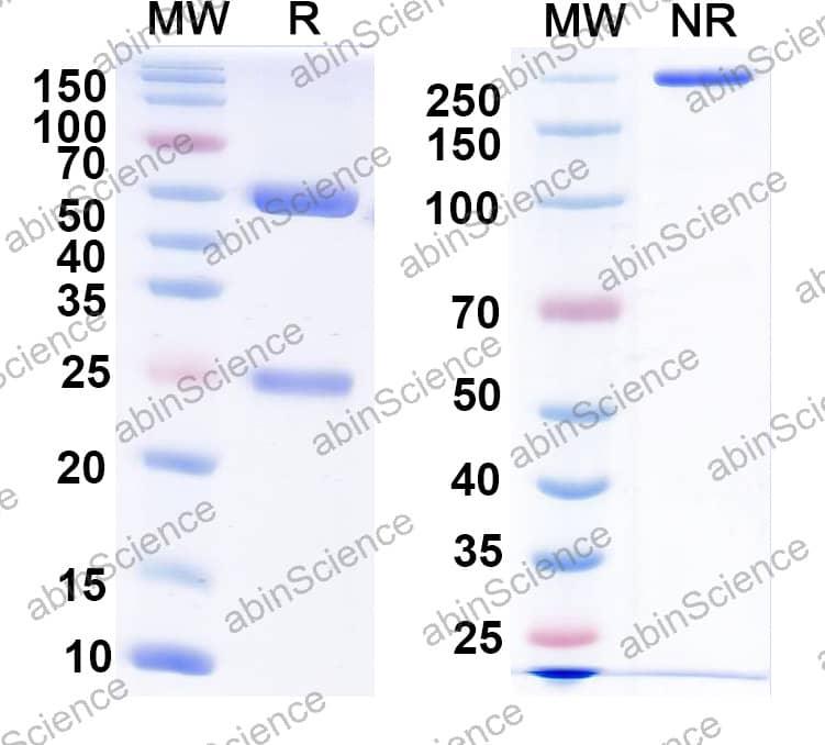 Anti-YFV Envelope Protein E Recombinant Antibody (SAA2432)
