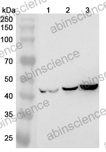 Anti-Human GFAP Antibody (N206B/9R)