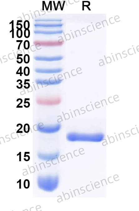 Api m 4 Allergen Recombinant Protein (N-His-SUMO)