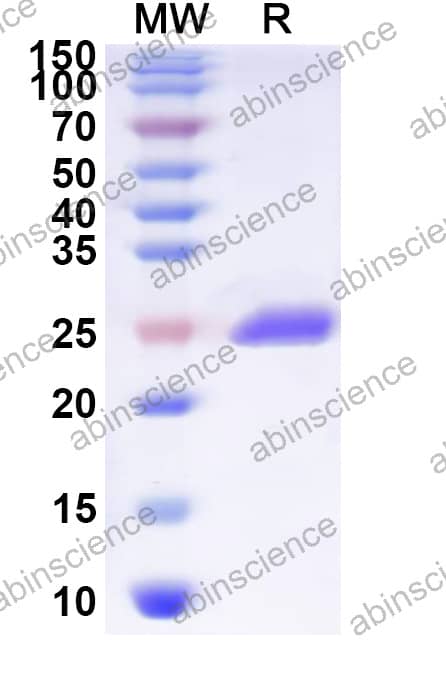 Rickettsia conorii ompA Recombinant Protein (N-His)