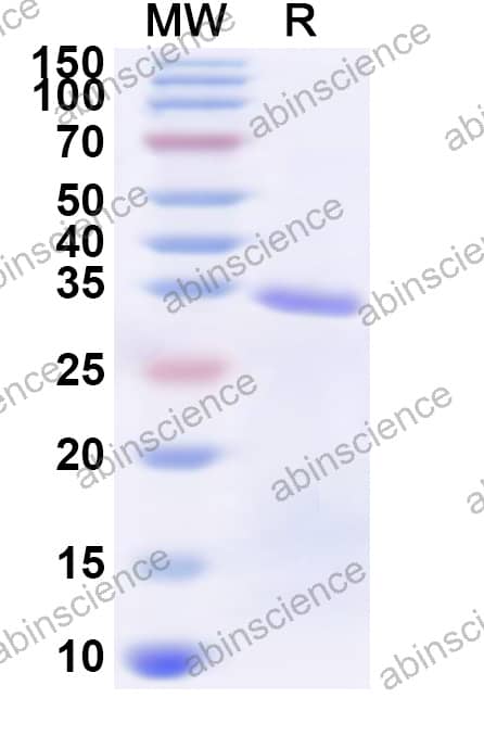 Toxocara canis TES-26 Recombinant Protein (N-His)