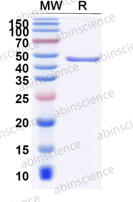 Equine NMDAR1 Recombinant Protein (N-His & C-strep)