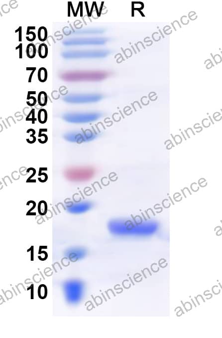 Vicugna pacos IL-21 Recombinant Protein (N-His)
