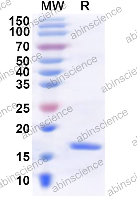 Vicugna pacos IL-2 Recombinant Protein (N-His)