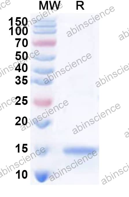 Vicugna pacos IL-4 Recombinant Protein (N-His)